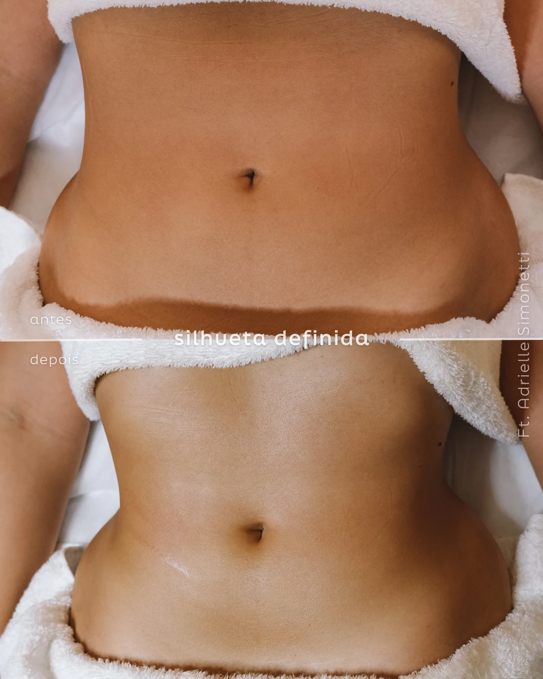 Massagem modeladora