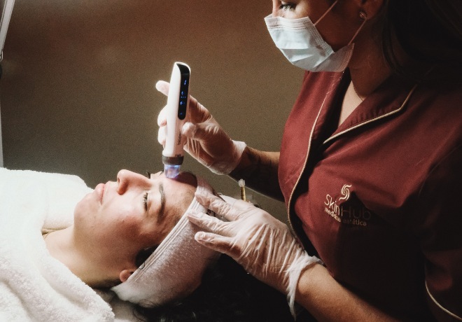 Microagulhamento Dermapen