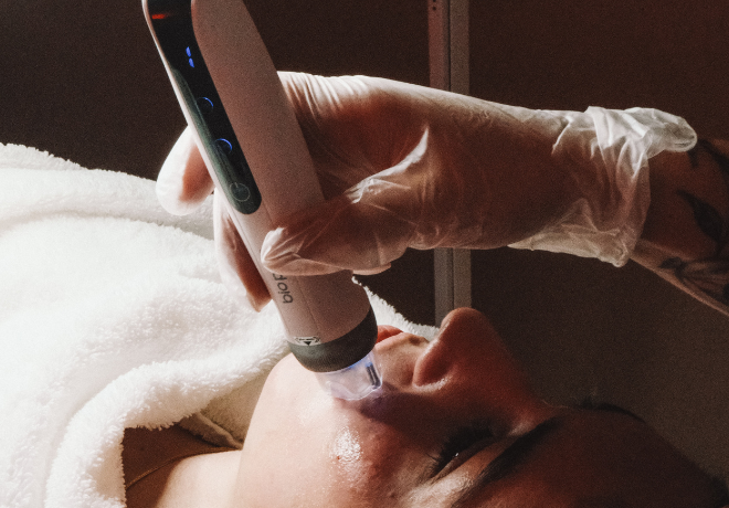Microagulhamento Dermapen