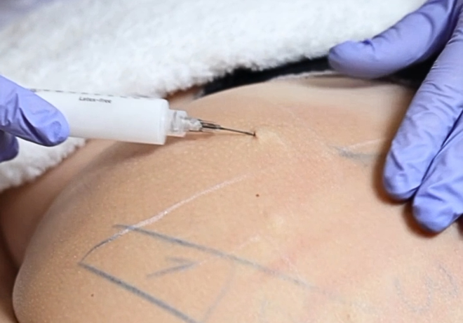 Bioestimulador corpo