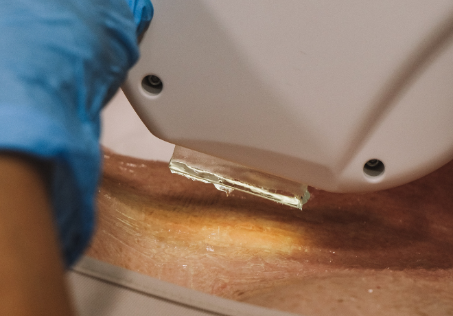 IPL Corporal