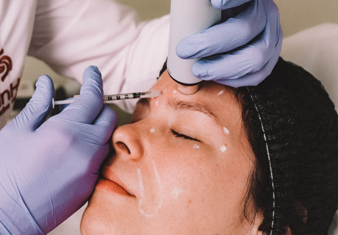 Botox Terço Superior