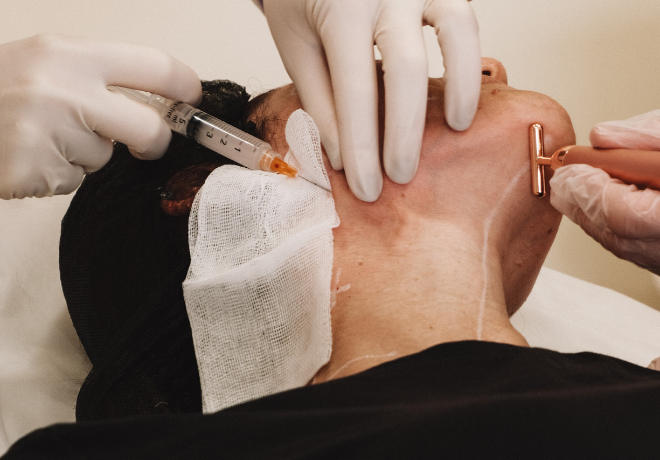 Bioestimulador Injetável face