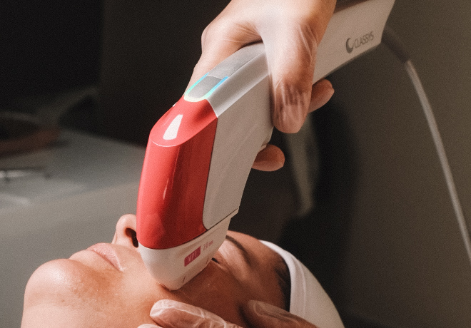 Ultraformer Lifting facial 2