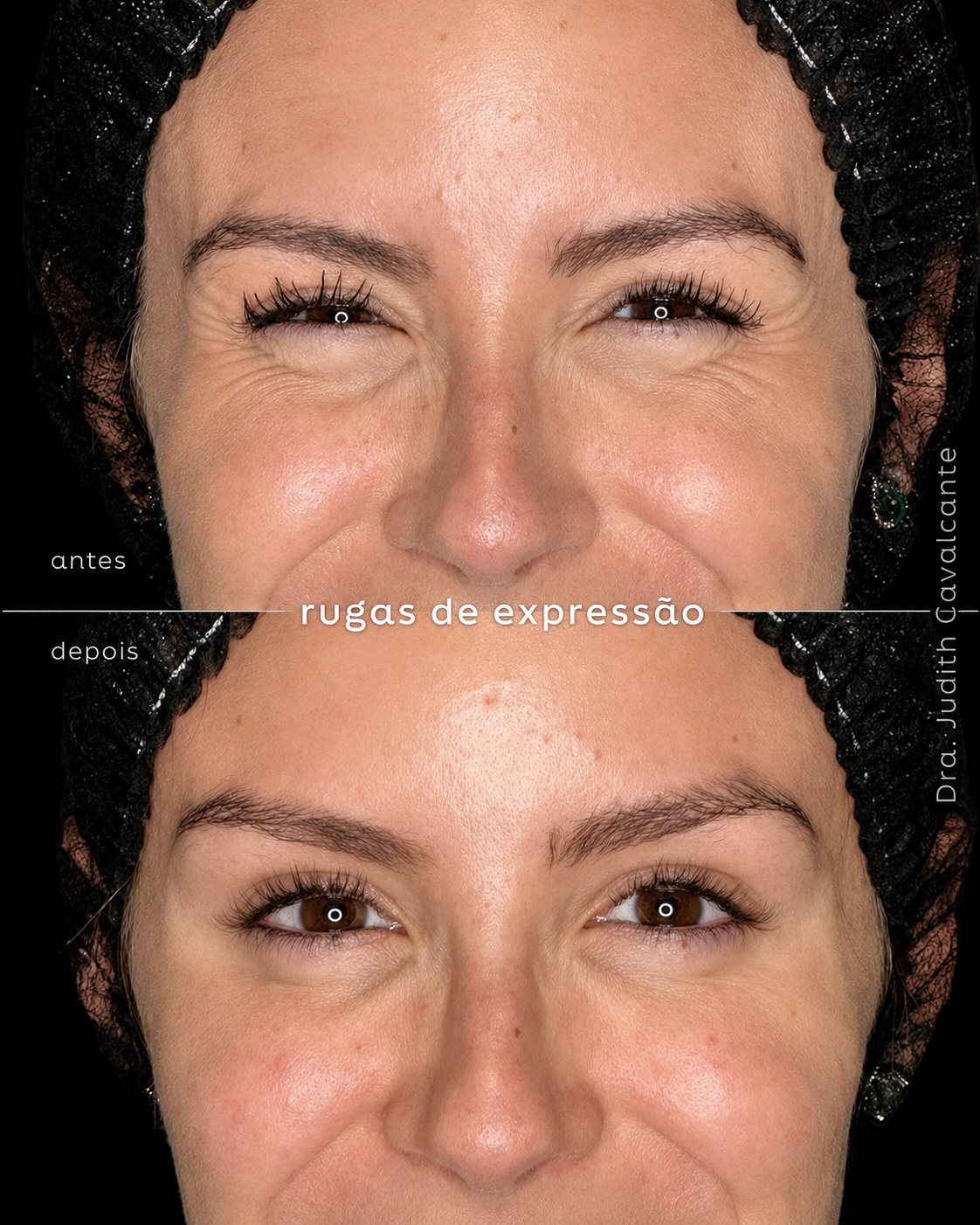 Pés de galinha 04