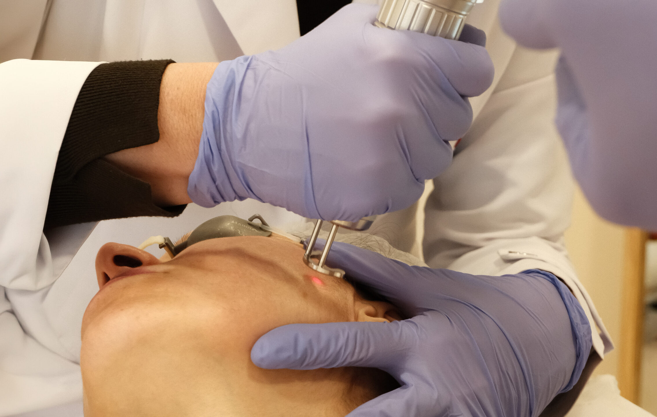 Laser Melasma