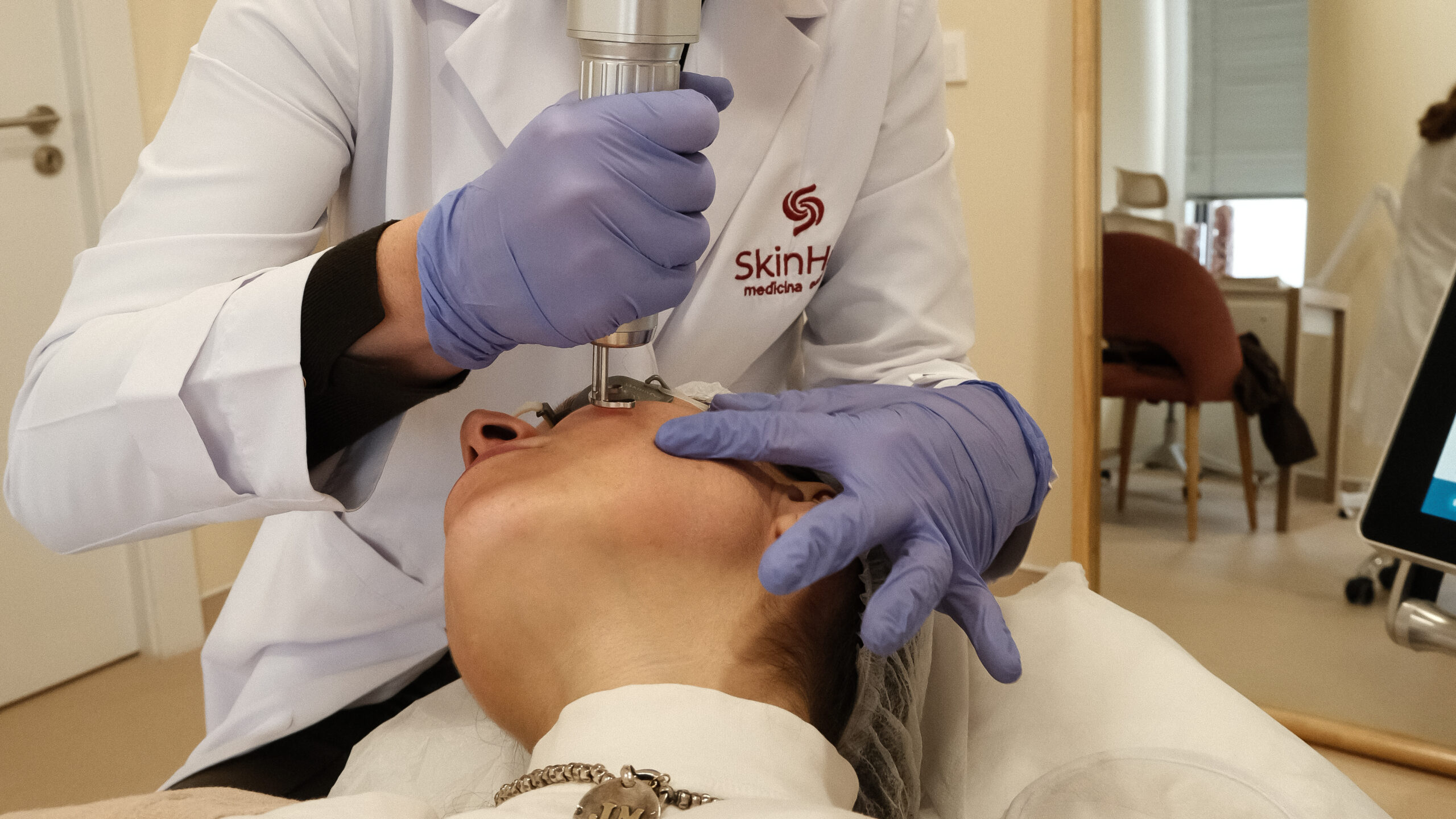 Laser Melasma