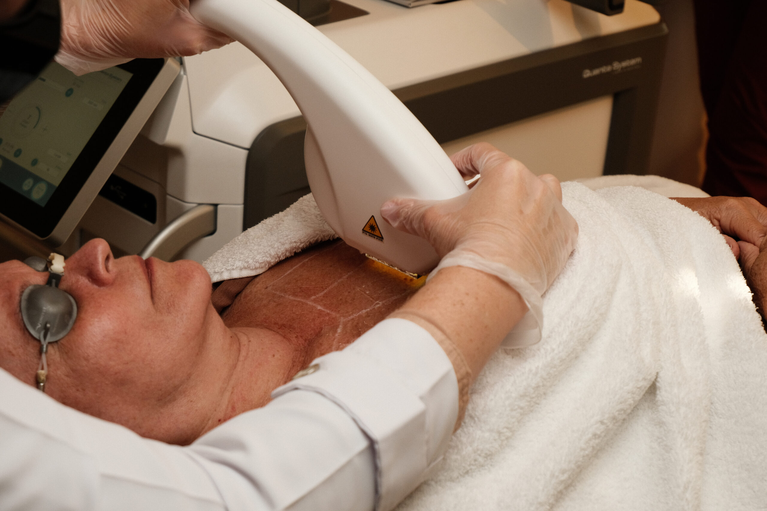 IPL Corporal