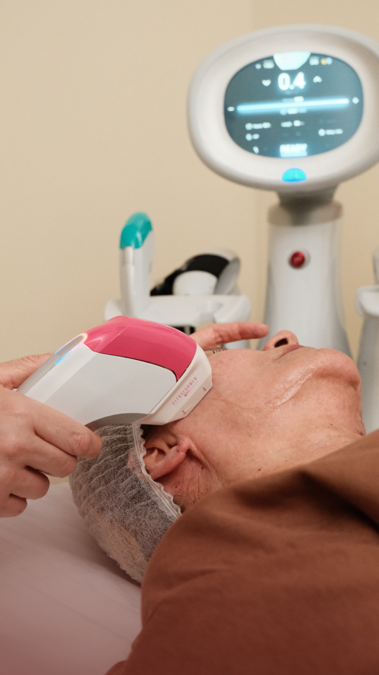 Ultraformer Lifting facial 1