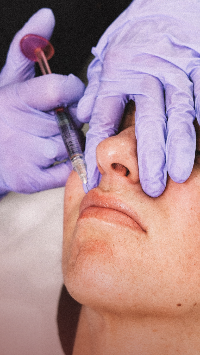 Preenchimento Labial