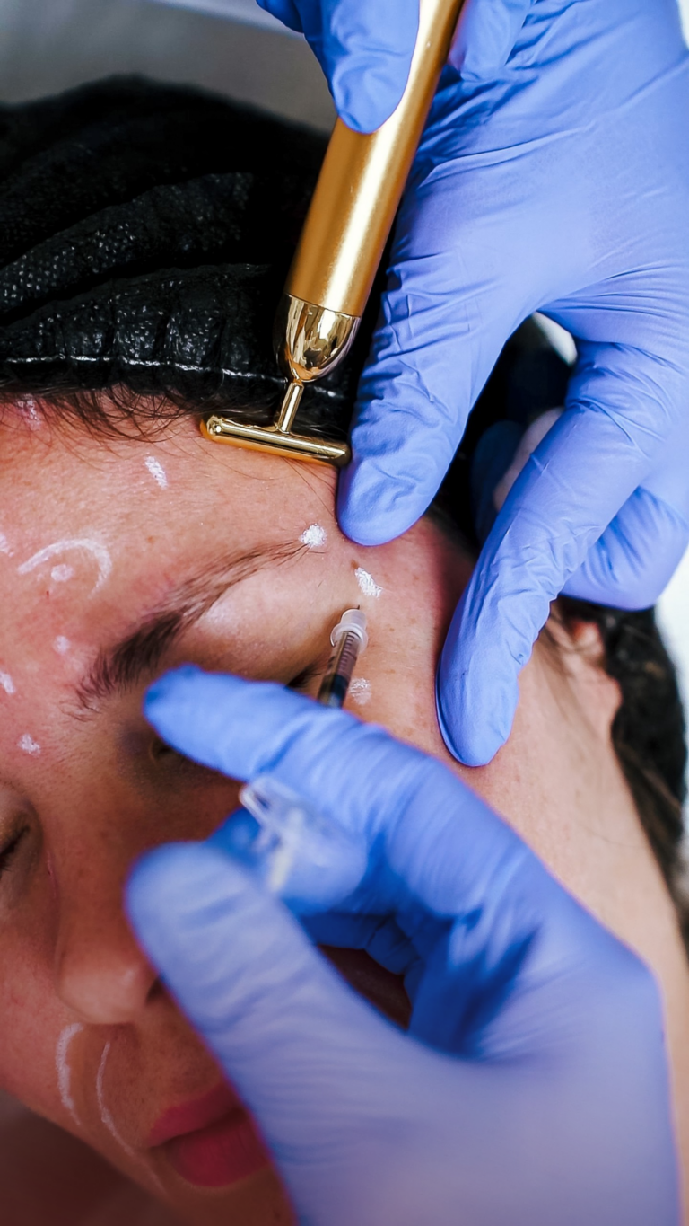 Botox pés de galinha ao alto