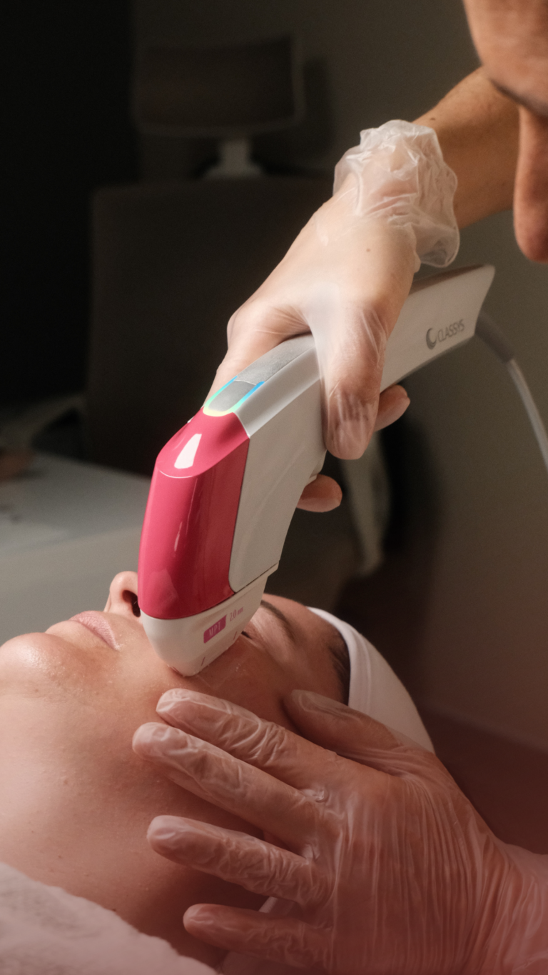 Ultraformer Lifting facial