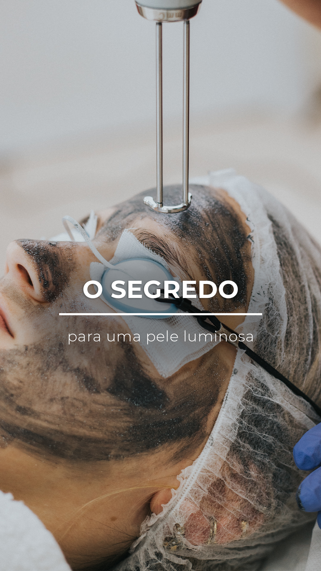 Natura Peel: O Peeling a Laser para uma Pele Luminosa