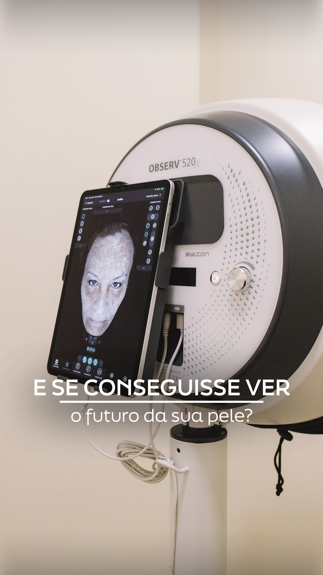 Análise de Pele: Diagnóstico Científico com Observ 520X no Porto