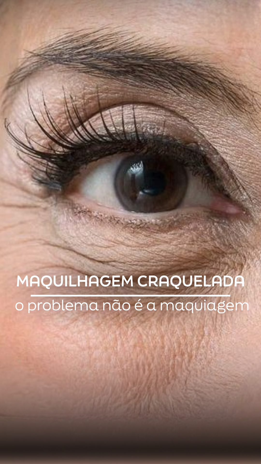 Rugas Finas Nos Olhos: Regeneração Cutânea Avançada no Porto