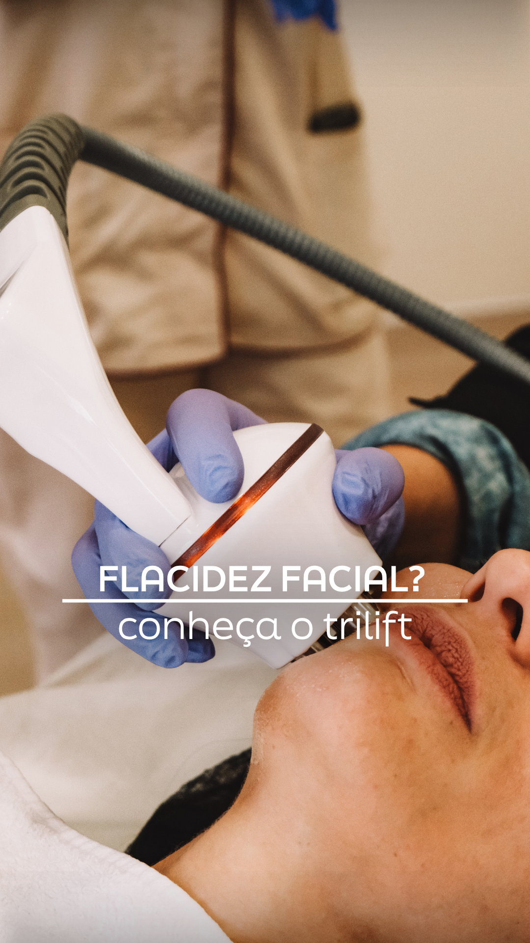Novo TriLift: A Evolução do Lifting Facial Não Invasivo no Porto
