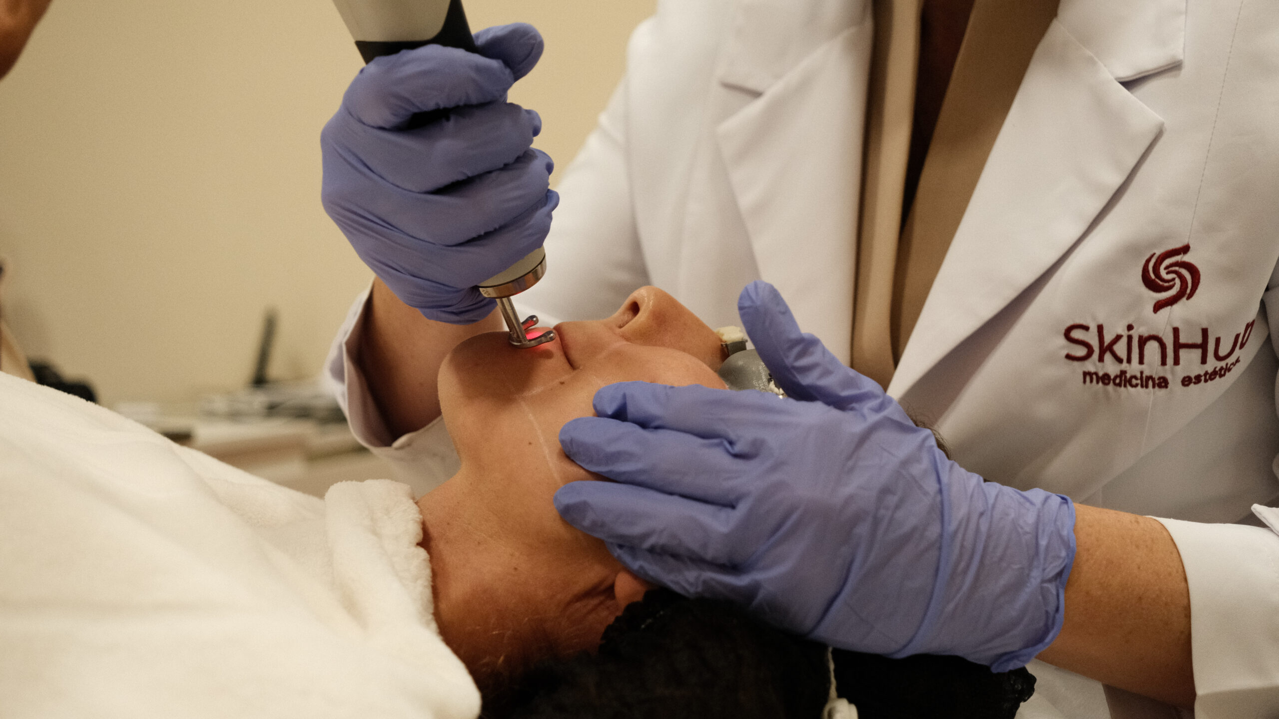Laser melasma
