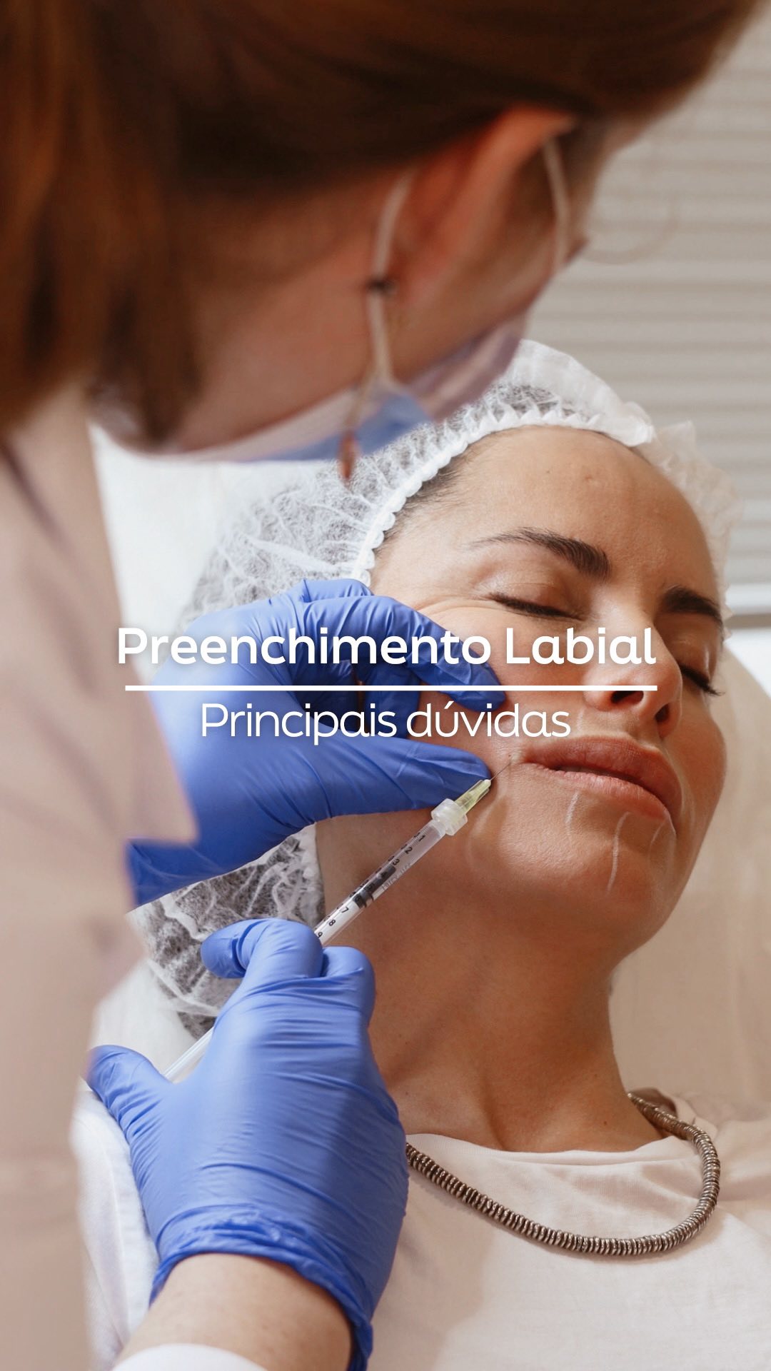 Preenchimento Labial: Esclareça as Principais Dúvidas Médicas